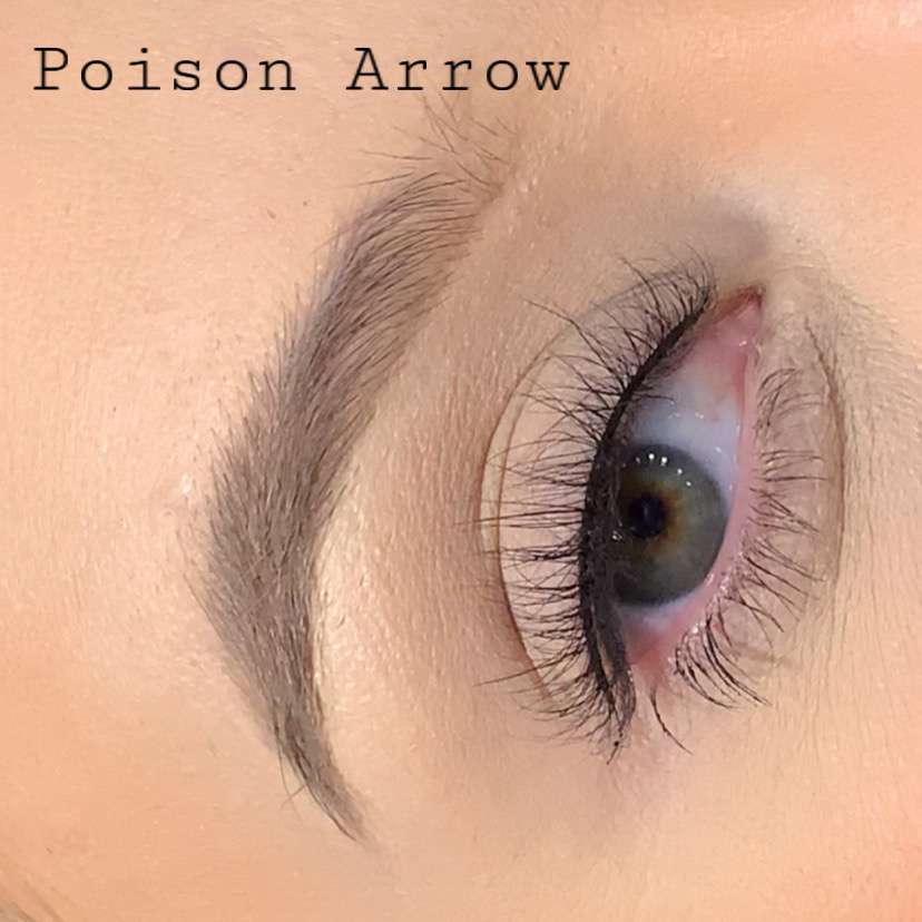 Poison Arrow