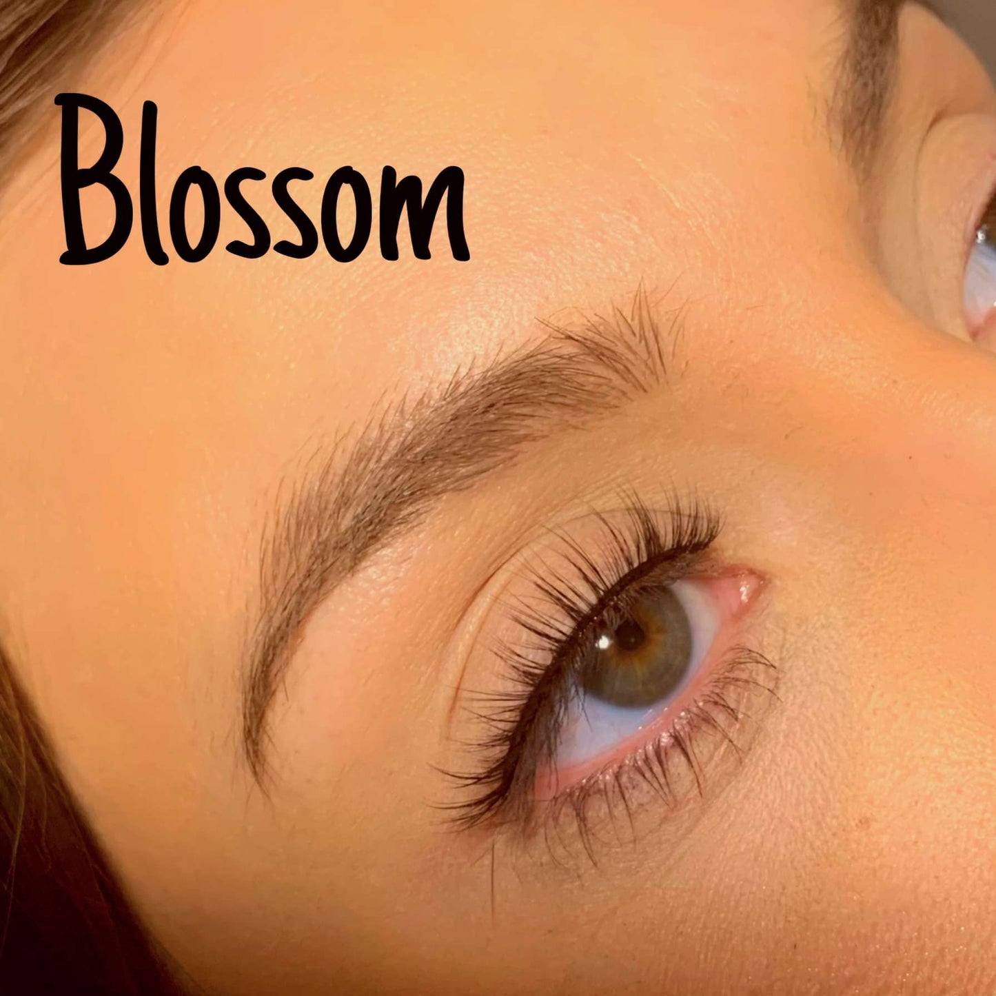 Blossom